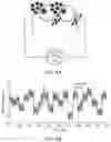 Fig. 06 - PORTABLE SYSTEM FOR GATHERING AND PROCESSING DATA FROM EEG, EOG, AND/OR IMAGING SENSORS