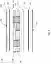 Fig. 06 - Hearing device with embedded integrated circuit chips