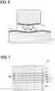 Fig. 06 - Joint structure, electronic device and method for manufacturing the joint structure