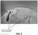 Fig. 04 - Corn rootworm biological control