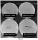 Fig. 10 - PLASMA IMMOBILIZATION OF BACTERIOPHAGES AND APPLICATIONS THEREOF
