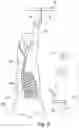 Fig. 03 - Cutting fore end from hanging half pig carcass
