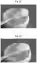 Fig. 03 - NOVEL HIGH PROTEIN, ACIDIFIED, DAIRY PRODUCT, METHOD OF PRODUCING IT, PROTEIN POWDER AND USE THEREOF