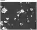 Fig. 07 - NOVEL COATED BULKING AGENT PARTICLES