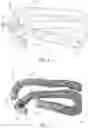 Fig. 04 - VEGETABLE BASED SNACK STICK