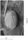 Fig. 09 - TEXTURE MODIFIED FOOD PRODUCT