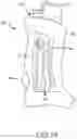 Fig. 10 - PIPE LIGHTER HOLDER AND TOOL