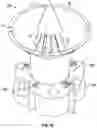 Fig. 13 - COLLECTION AND STORAGE DEVICE FOR ACCESSORIES AND OTHER ORGANIC OR NON-ORGANIC DISPOSABLES