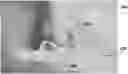 Fig. 01 - NASAL MASK METHOD AND DEVICES