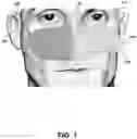 Fig. 02 - NASAL MASK METHOD AND DEVICES