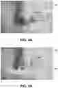 Fig. 03 - NASAL MASK METHOD AND DEVICES