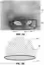 Fig. 04 - NASAL MASK METHOD AND DEVICES