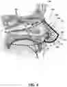 Fig. 09 - NASAL MASK METHOD AND DEVICES