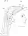 Fig. 04 - HAIR TOPPER