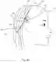 Fig. 07 - HAIR TOPPER