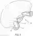 Fig. 06 - Shower Cap With Ear Loops