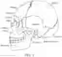 Fig. 02 - Energy dissipating protective gear