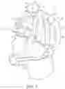 Fig. 09 - Energy dissipating protective gear