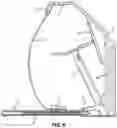 Fig. 06 - Gait correction treadmill and footwear system