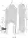 Fig. 09 - Footwear having therapeutic light source