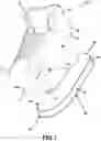 Fig. 02 - Wearable shoe shaper