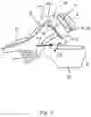 Fig. 03 - Method for automatically fitting a shoe upper onto a last