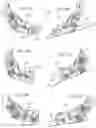 Fig. 27 - Systems and methods for an improved ratcheting device including pivoting tooth