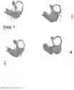 Fig. 02 - Gastrointestinal capsule and method