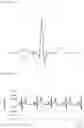 Fig. 02 - Apparatus, method, and computer-readable recording medium for measuring size of electrocardiography signal using electrocardiography signal using Hilbert transform