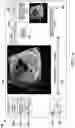Fig. 07 - Apparatus and method for fetal intelligent navigation echocardiography
