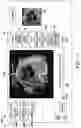 Fig. 08 - Apparatus and method for fetal intelligent navigation echocardiography