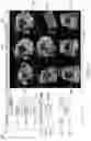 Fig. 15 - Apparatus and method for fetal intelligent navigation echocardiography