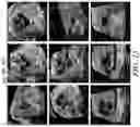 Fig. 16 - Apparatus and method for fetal intelligent navigation echocardiography