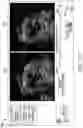 Fig. 18 - Apparatus and method for fetal intelligent navigation echocardiography