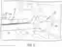 Fig. 04 - Systems and methods for Percutaneous Spinal Interbody Fusion (PSIF)