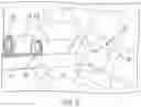 Fig. 06 - Systems and methods for Percutaneous Spinal Interbody Fusion (PSIF)