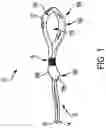 Fig. 02 - All-suture anchor and deployment assembly