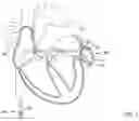 Fig. 02 - OCCLUSIVE MEDICAL DEVICE