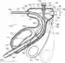 Fig. 01 - Medical device for stone management