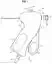 Fig. 02 - Medical device for stone management