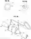 Fig. 09 - Medical device for stone management