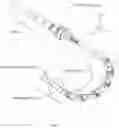 Fig. 02 - Minimally-invasive surgery equipment