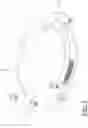 Fig. 02 - Device for the angular correction of a lower limb in pediatric patients