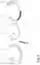 Fig. 07 - Device for the angular correction of a lower limb in pediatric patients