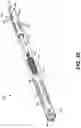 Fig. 22 - Instrument for inserting an interspinous process implant