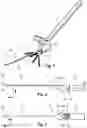 Fig. 02 - DISTAL RADIUS FRACTURE FIXATION DEVICE