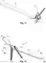 Fig. 06 - DISTAL RADIUS FRACTURE FIXATION DEVICE