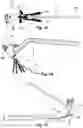 Fig. 07 - DISTAL RADIUS FRACTURE FIXATION DEVICE