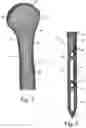 Fig. 02 - Proximal humeral stabilization systems and methods thereof