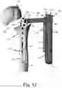 Fig. 08 - Proximal humeral stabilization systems and methods thereof